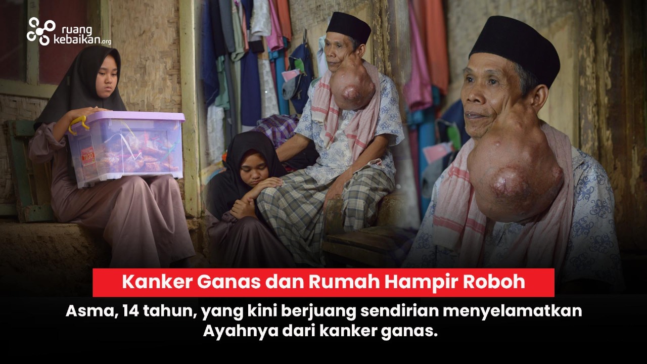 Asma Berjuang Sendirian Untuk Selamatkan Ayah Dari Kanker Ganas