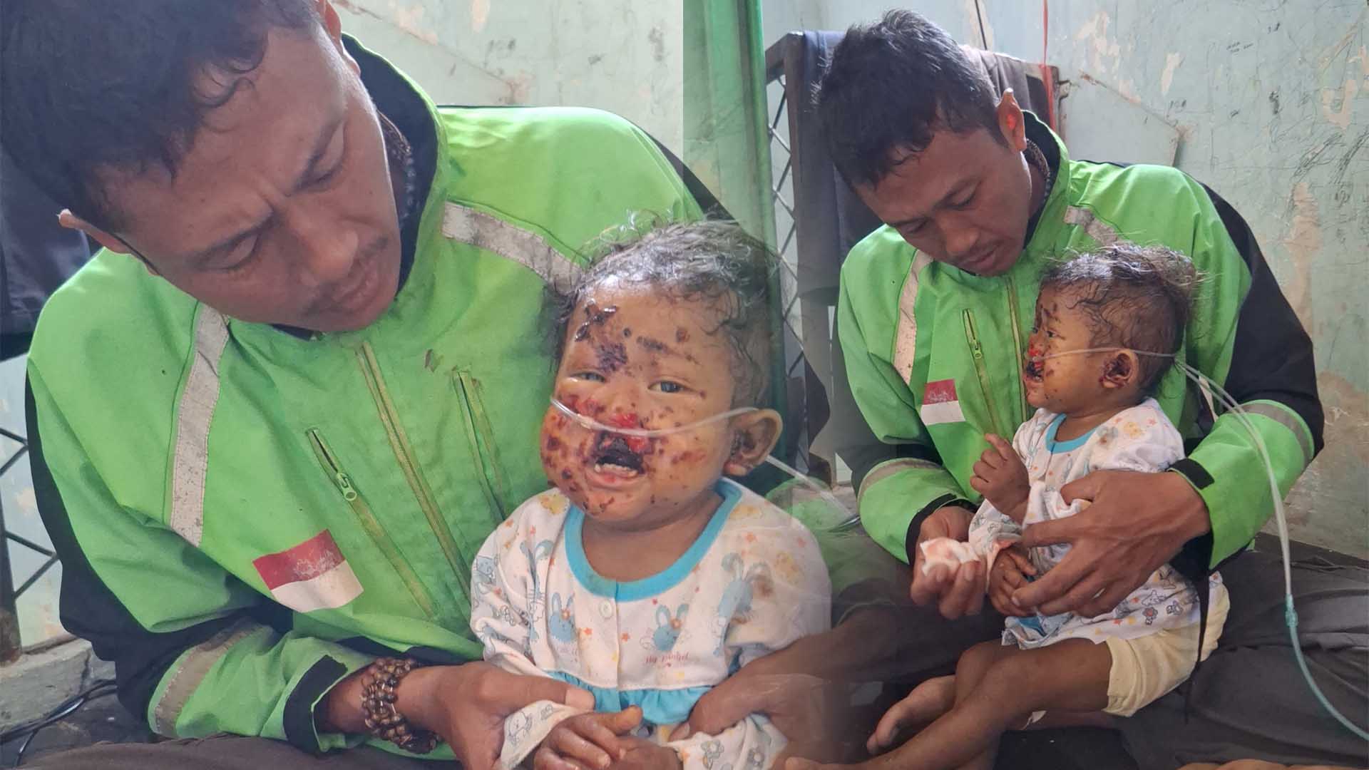 Ribuan Anak Sakit Kronis Terancam Tak Bisa Berobat