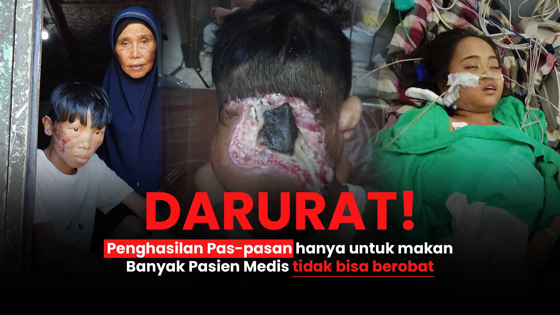Ribuan Anak Sakit Kronis Terancam Tak Bisa Berobat