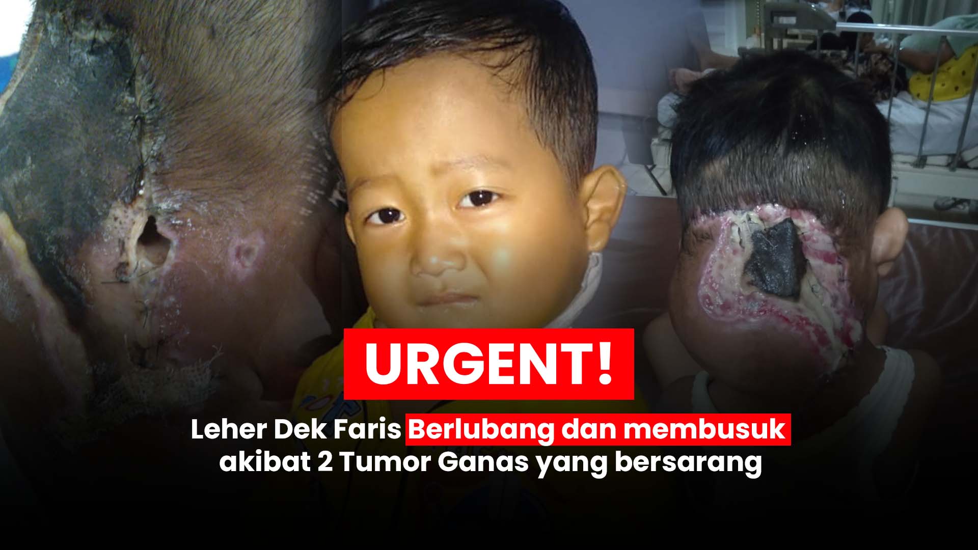 Ribuan Anak Sakit Kronis Terancam Tak Bisa Berobat