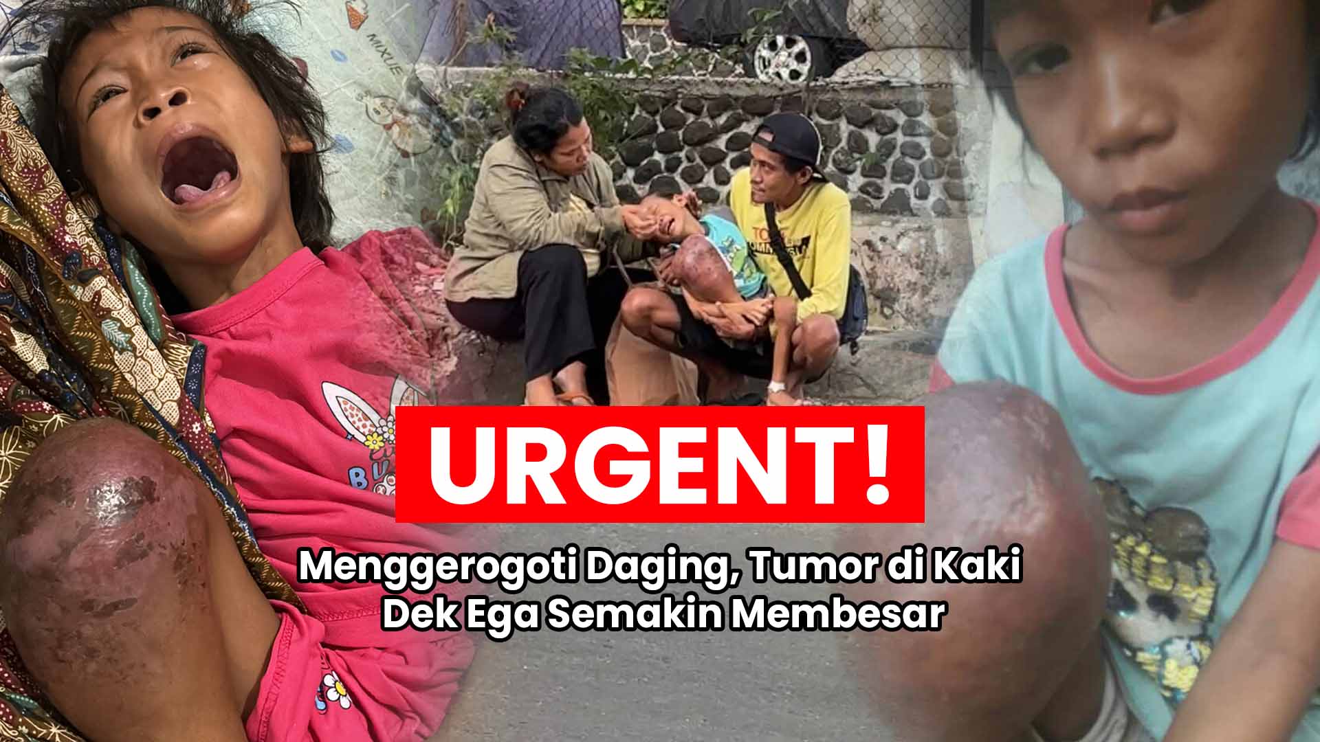 Ribuan Anak Sakit Kronis Terancam Tak Bisa Berobat