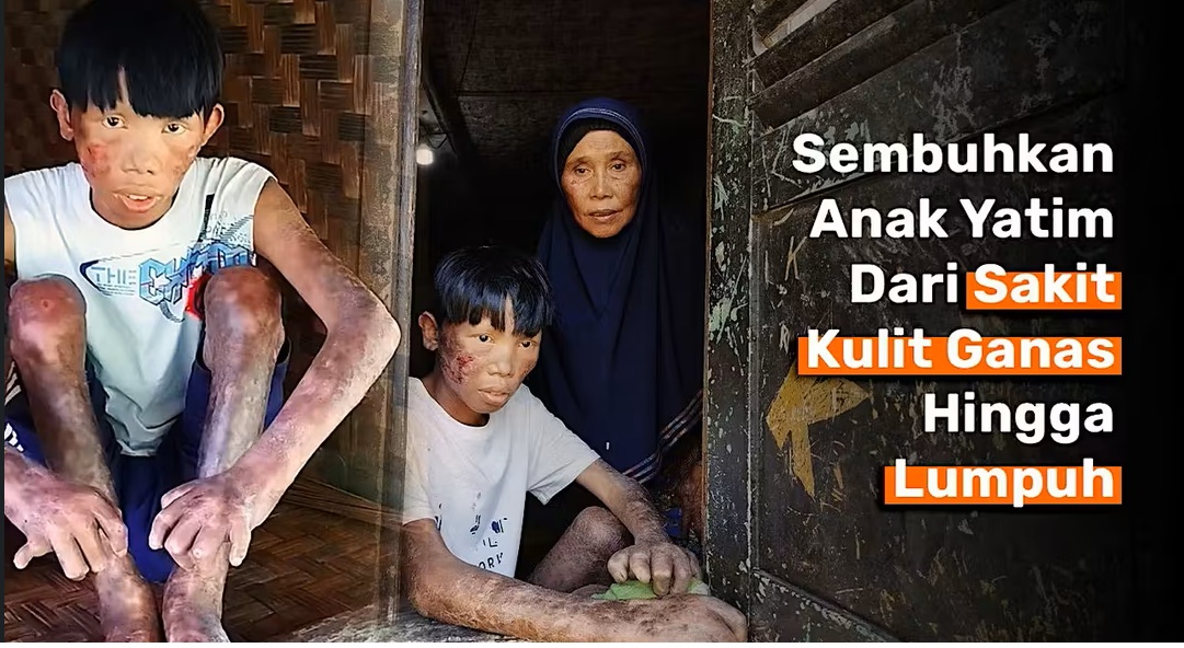 Ribuan Anak Sakit Kronis Terancam Tak Bisa Berobat