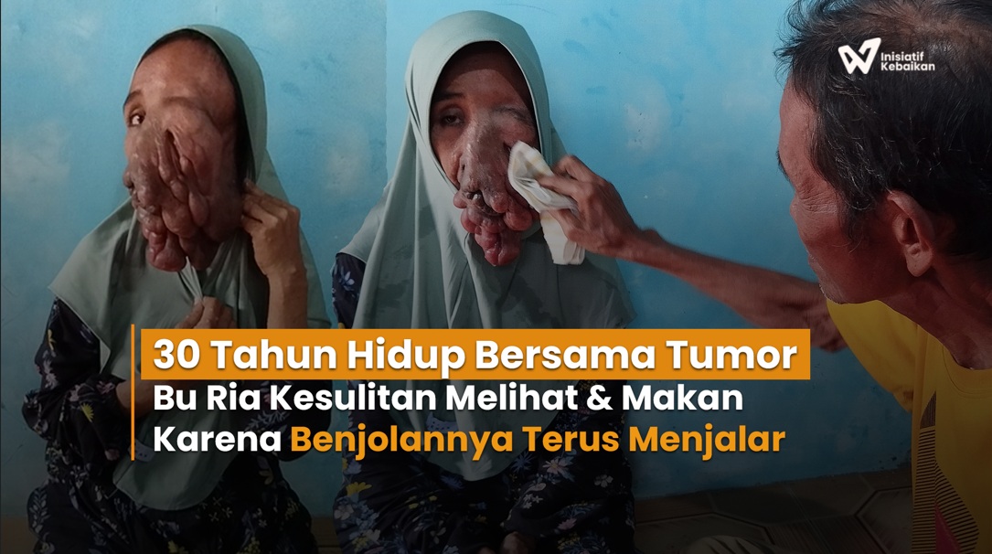 Ribuan Anak Sakit Kronis Terancam Tak Bisa Berobat