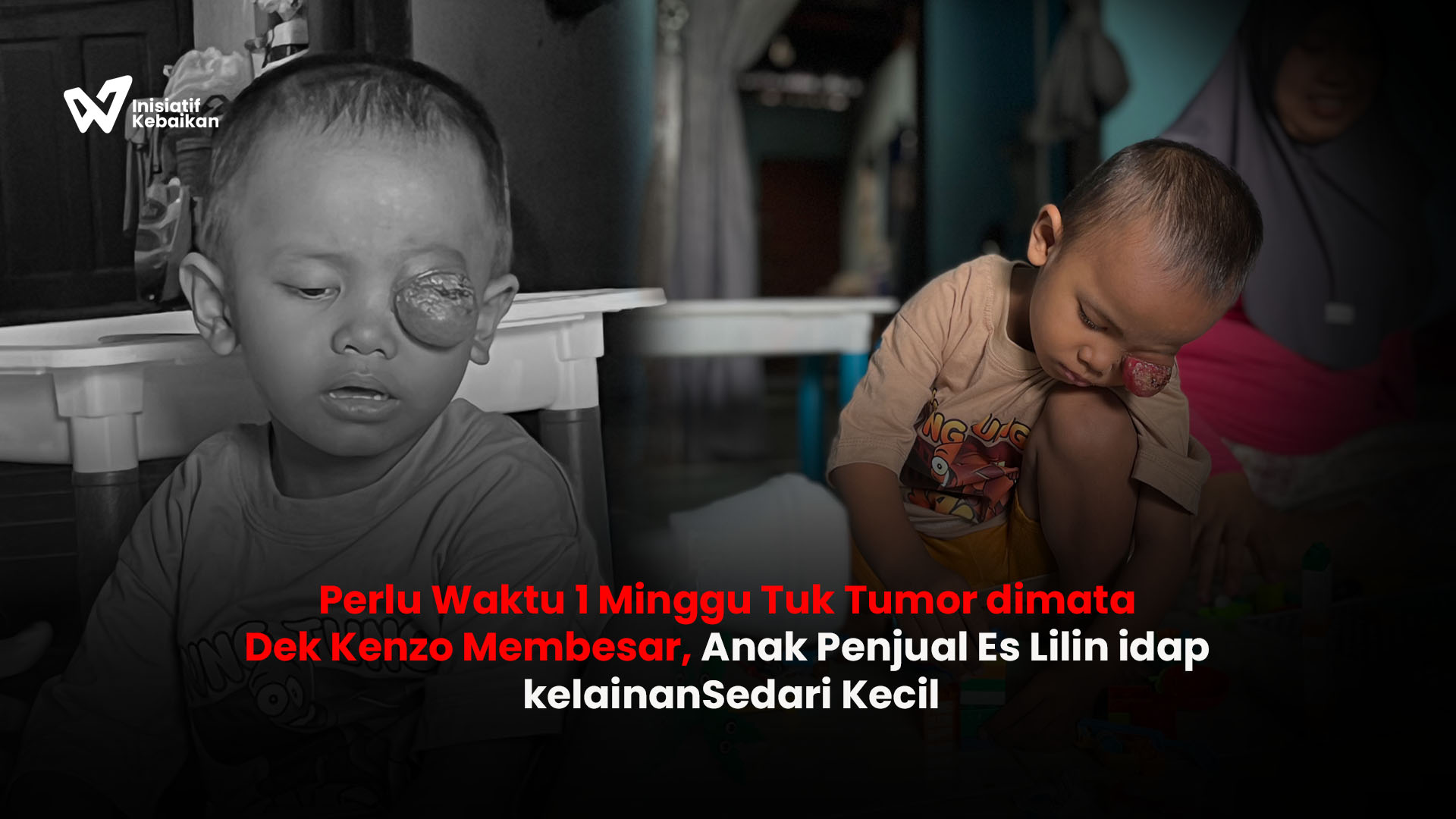 Ribuan Anak Sakit Kronis Terancam Tak Bisa Berobat