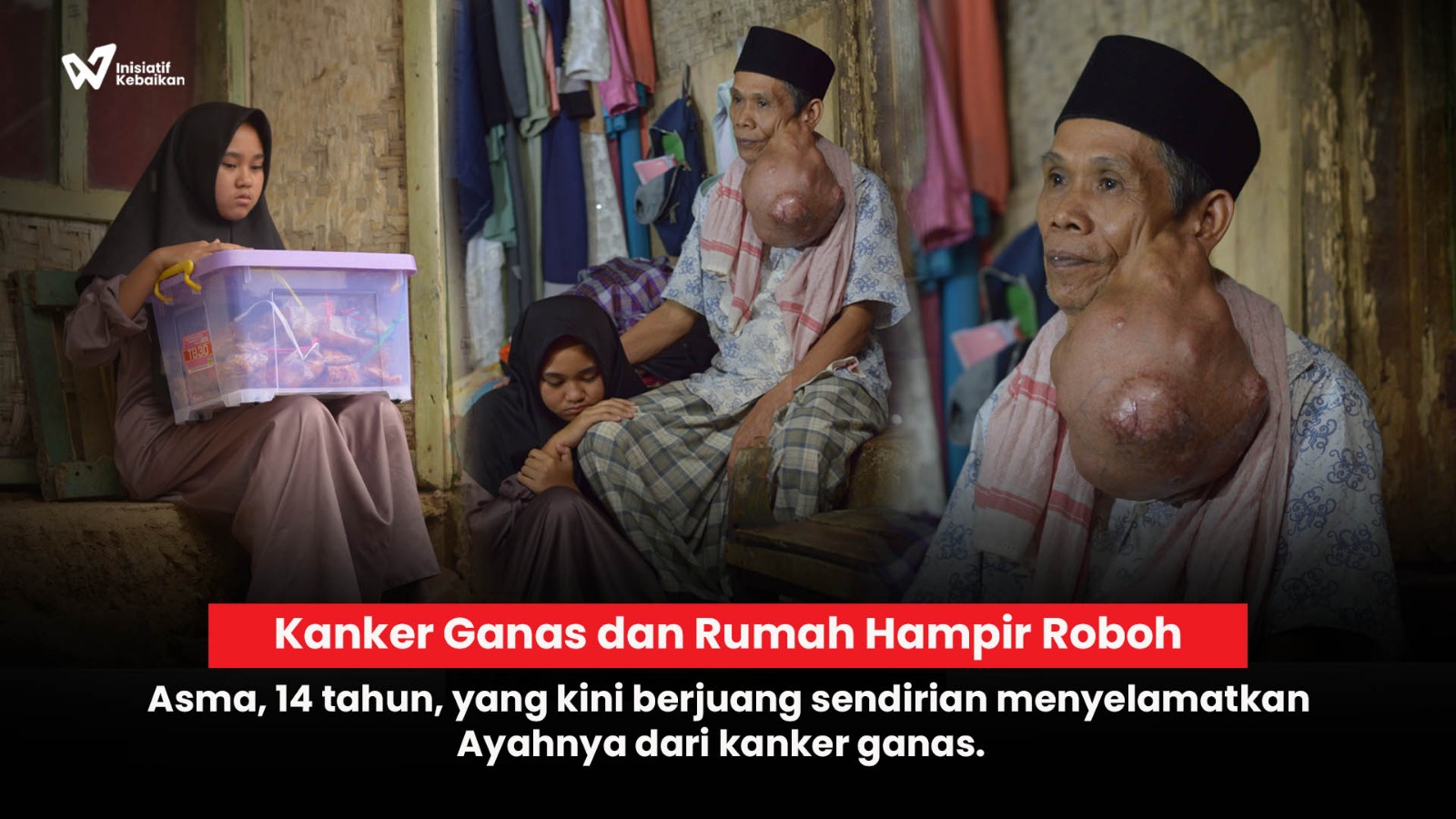 Ribuan Anak Sakit Kronis Terancam Tak Bisa Berobat