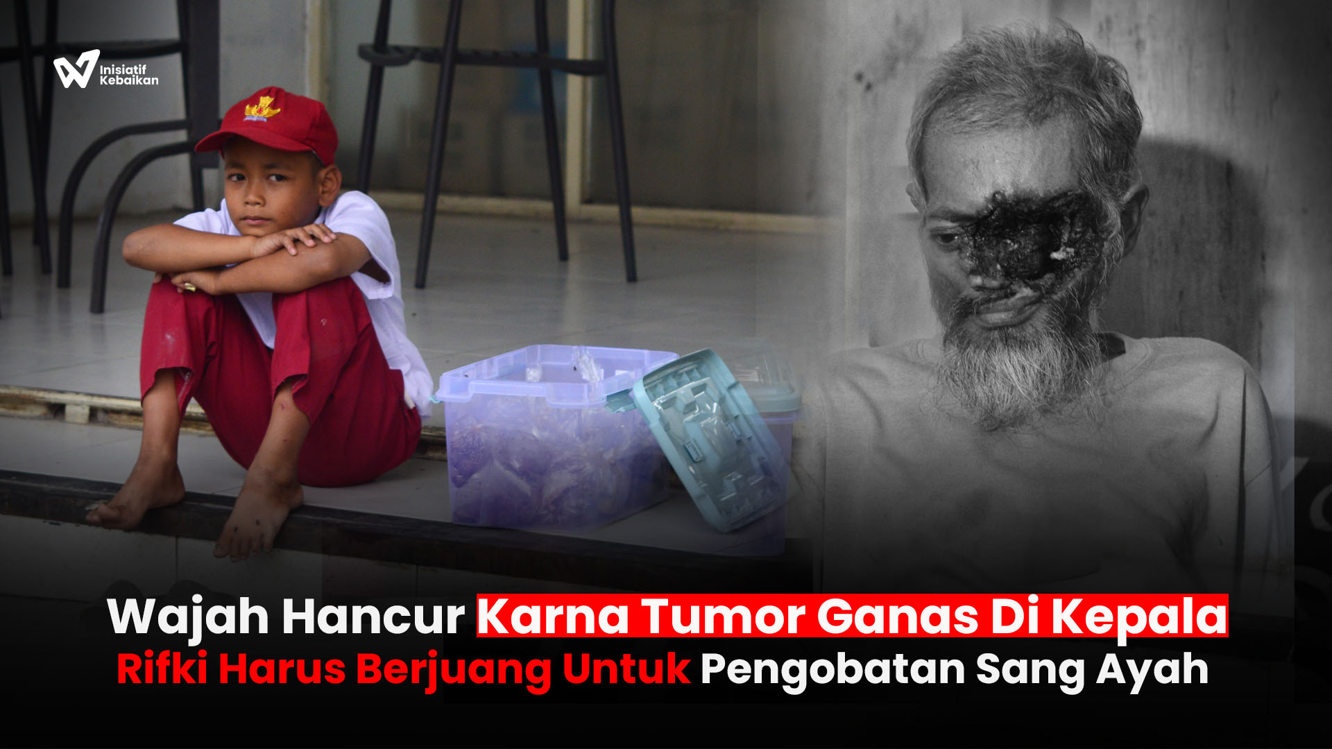 Ribuan Anak Sakit Kronis Terancam Tak Bisa Berobat